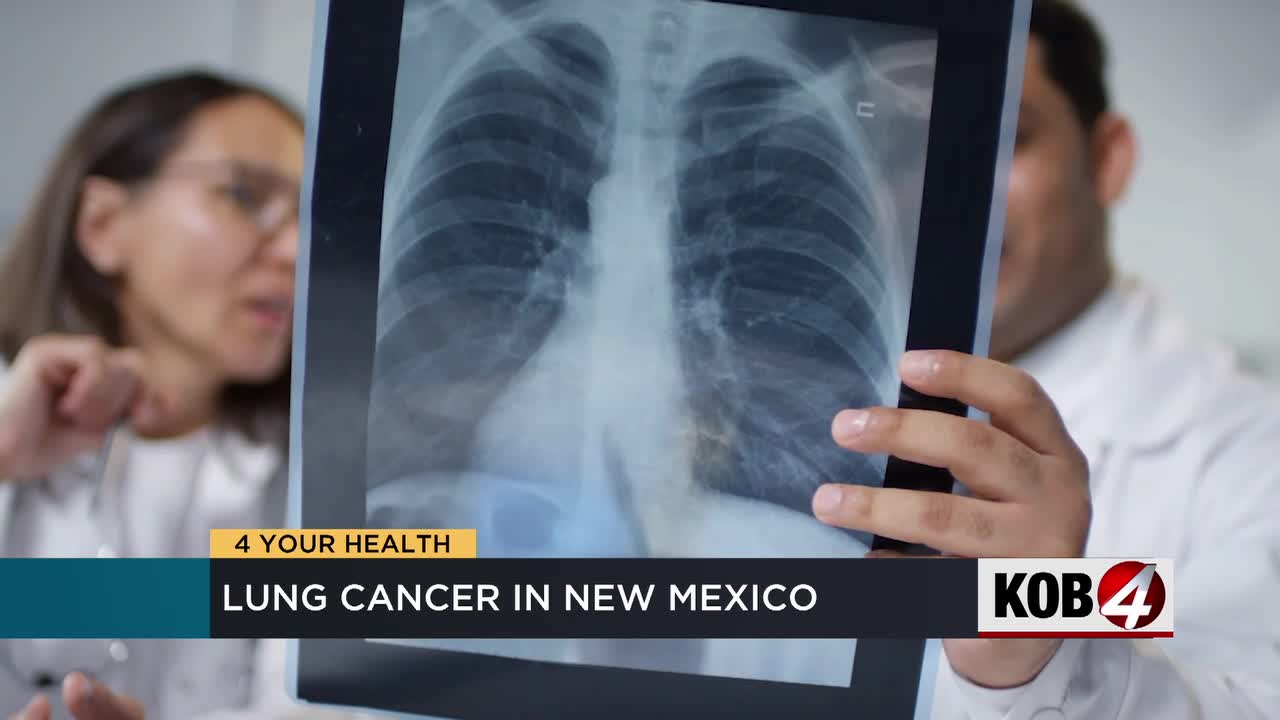 Report: New Mexico lags behind in lung cancer treatment
